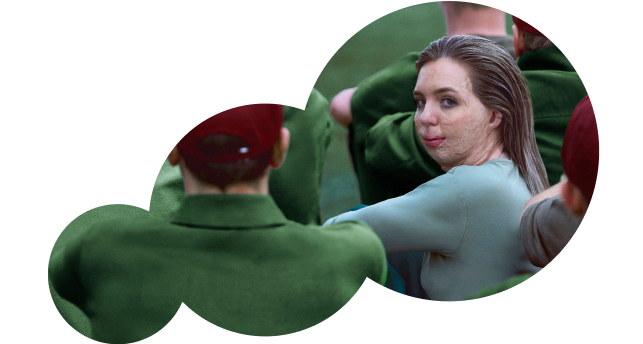 Vrouw met brandwonden in het gezicht