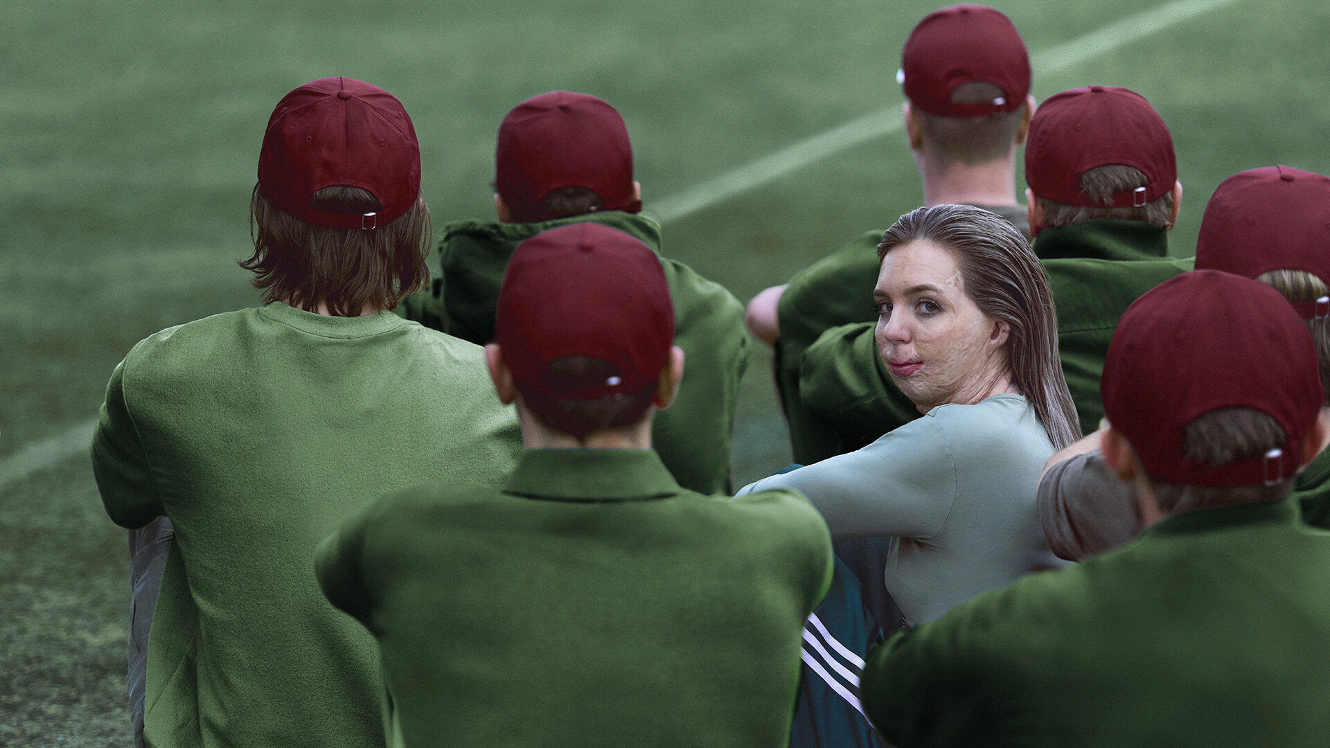 Vrouw met brandwonden in gezicht